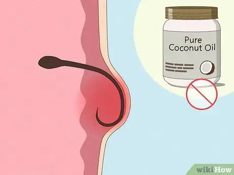 Image titled Shave Your Bikini Area with Coconut Oil Step 15