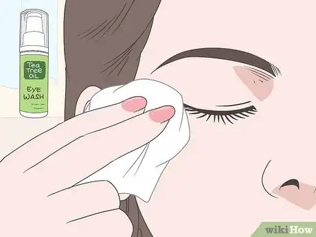 Image titled Treat Blepharitis Step 14