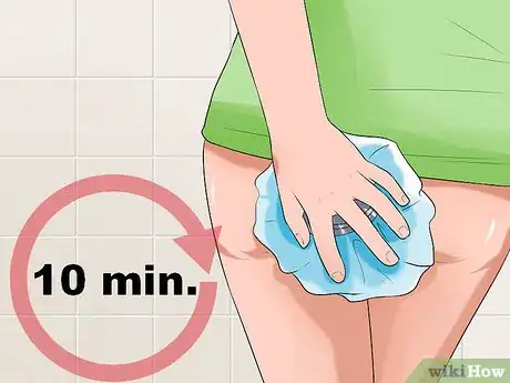 Image titled Stop Hemorrhoids from Itching Step 5