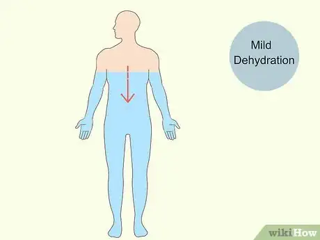 Image titled Reduce Foamy Urine Step 4