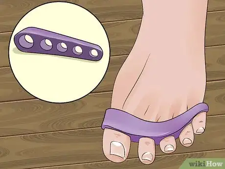 Image titled Get Rid of Toe Cramps Step 10