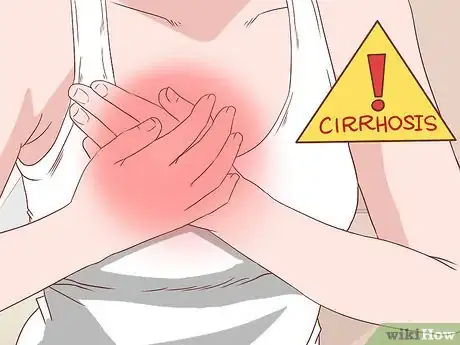 Image titled Recognize Cirrhosis Step 5