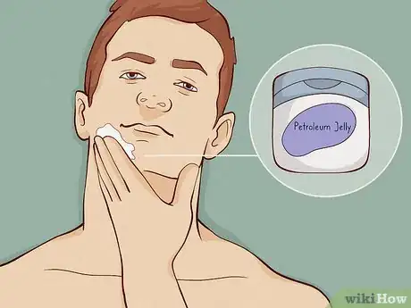 Image titled Get Rid of Shaving Rash Step 2