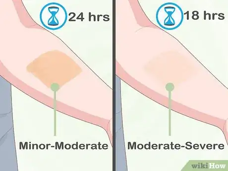 Image titled Test Iodine Levels Step 3