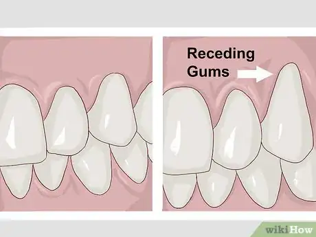 Image titled Stimulate Gum Growth Step 10