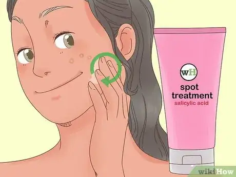 Image titled Remove the Redness of a Pimple Step 8