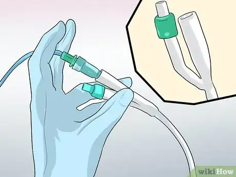 Image titled Remove a Catheter Step 5