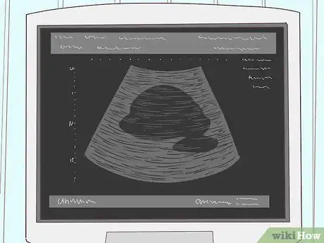 Image titled Prepare for a Pelvic Ultrasound Step 18