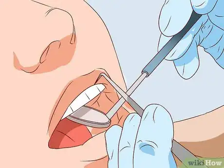 Image titled Stop Tooth Nerve Pain Step 4