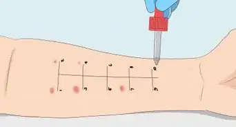 Identify Trigger Foods