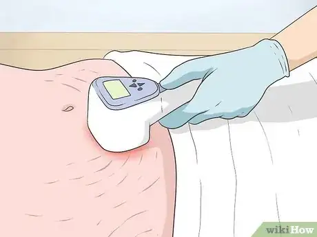 Image titled Get Rid of Stretch Marks at Home Step 12