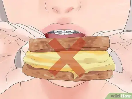 Image titled Eat With Braces Step 7