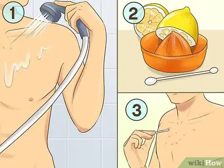 Image titled Get Rid of Acne Scars on Your Chest Step 12