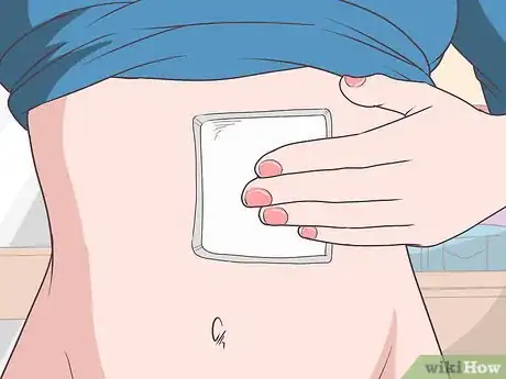 Image titled Get Rid of Stitch Marks Step 1