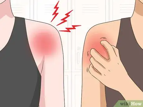 Image titled Diagnose Shoulder Pain Step 2