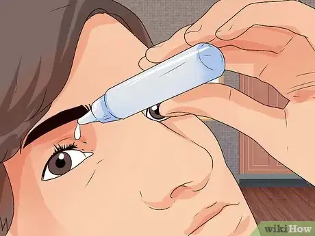 Image titled Remove a Speck From Your Eye Step 5