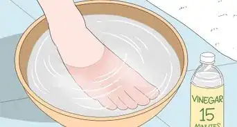 Remove Splinters from Feet