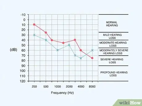 Image titled Read an Audiogram Step 13