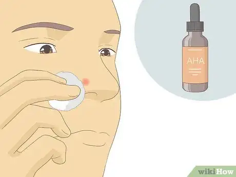 Image titled Get Rid of Acne Redness Fast Step 9