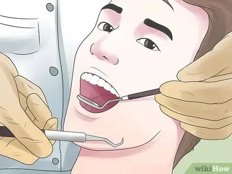 Image titled Clean Your Teeth After Wisdom Teeth Removal Step 11