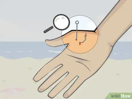 Image titled Pull a Fish Hook from Your Finger Step 10