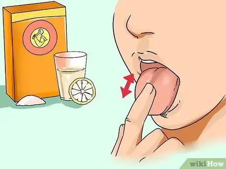 Image titled Get Rid of White Tongue Step 5