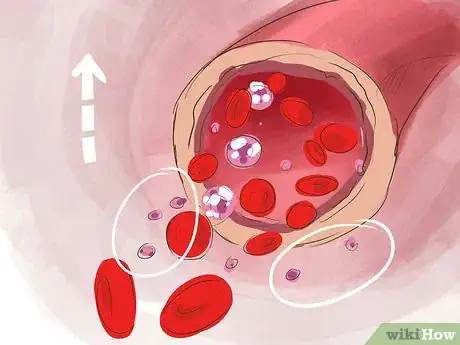 Image titled Increase Platelets Step 3