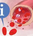 Increase Red Blood Cell Count