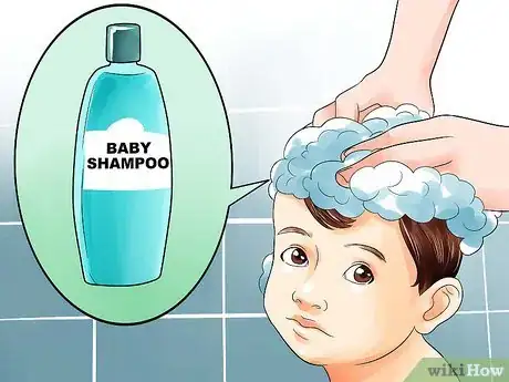 Image titled Easily Clean Baby's Cradle Cap Dandruff Without Hurting the Baby Step 2