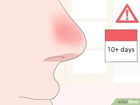 Image titled Clear a Stuffy Nose Step 18