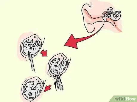 Image titled Unclog the Inner Ear or Eustachian Tube Step 13