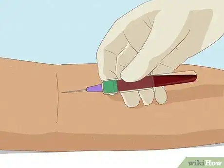 Image titled Treat Diabetic Ketoacidosis Step 8