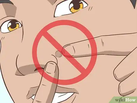 Image titled Remove Facial Warts Step 15