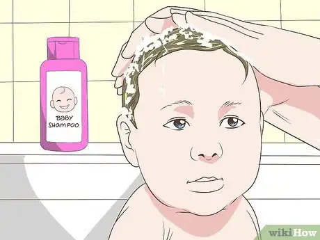 Image titled Heal Scalp Eczema Step 20