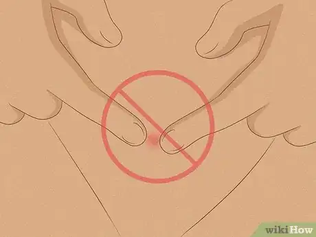 Image titled Prevent Ingrown Hairs on Your Bikini Line After Waxing Step 11