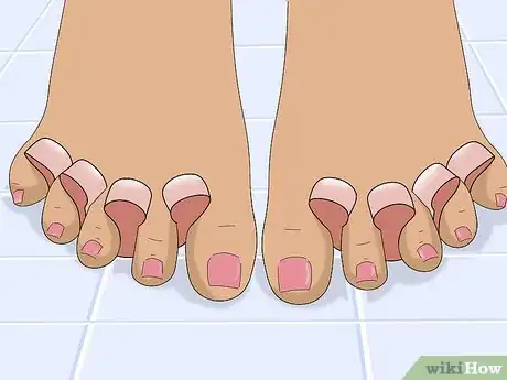 Image titled Wear Toe Rings Step 12