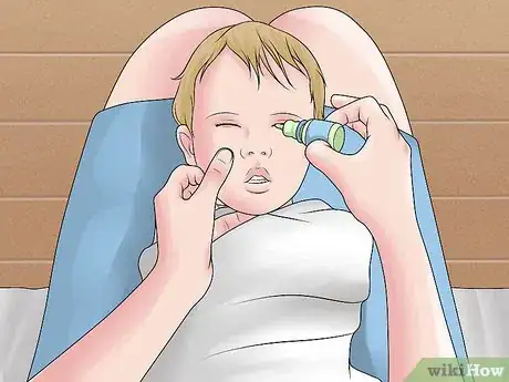 Image titled Easily Give Eyedrops to a Baby or Child Step 14