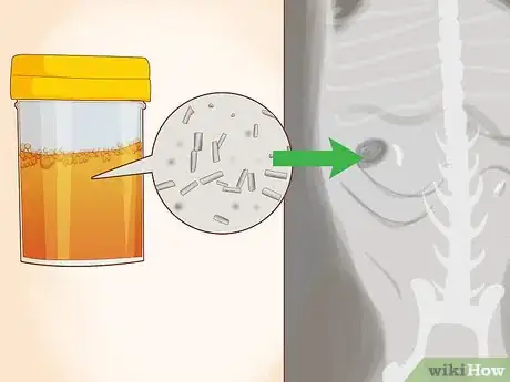 Image titled Prevent Kidney Stones in Dogs Step 10