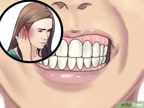 Image titled Reduce Jaw Pain Step 1