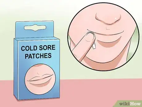 Image titled Heal Cold Sores Step 9