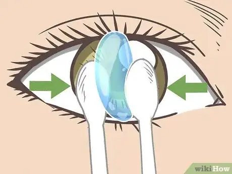 Image titled Remove Contact Lenses with Cotton Swabs Step 9