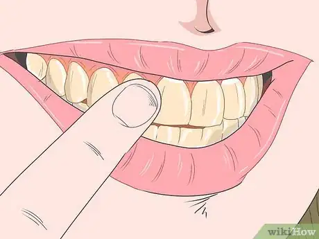 Image titled Use Activated Charcoal for Teeth Whitening Step 13