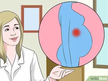 Image titled Detect Appendicitis During Pregnancy Step 3