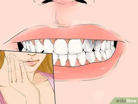 Image titled Heal Dental Cavities Naturally Step 7