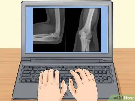 Image titled Prepare for an X‐ray Step 14