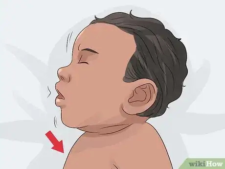 Image titled Spot Meningitis in Babies Step 5