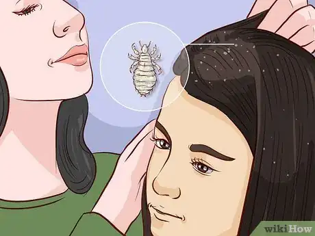 Image titled Get Rid of Lice Step 1