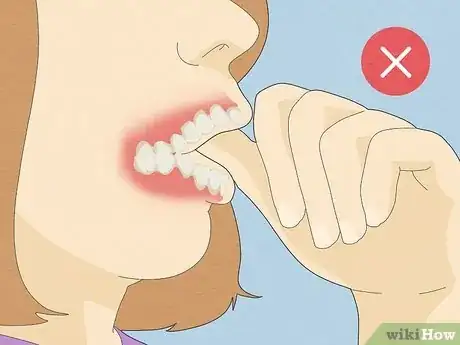 Image titled Straighten Your Teeth Without Braces Step 3