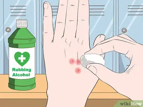 Image titled Stop Mosquito Bites from Itching Step 9