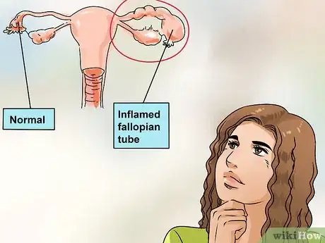 Image titled Cure Vaginal Infections Without Using Medications Step 10